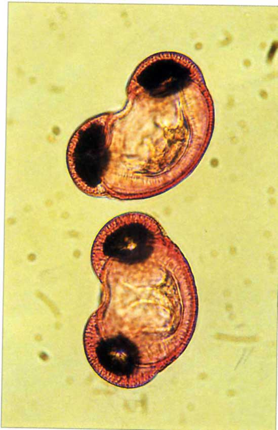 Ingrandimento al microscopio di polline di Pinus pinea.